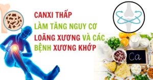 CANXI THẤP LÀM TĂNG NGUY CƠ LOÃNG XƯƠNG VÀ CÁC BỆNH CƠ XƯƠNG KHỚP